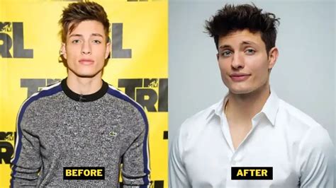 matt rife glow up|More.